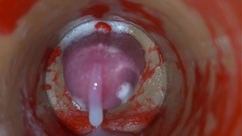 Insemination rage-anger Internal Camera Grips Deep Male Climax