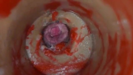 Insemination rage-anger Internal Camera Grips Deep Male Climax