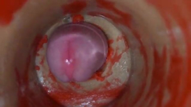 Insemination rage-anger Internal Camera Grips Deep Male Climax