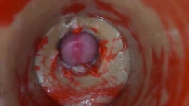 Insemination rage-anger Internal Camera Grips Deep Male Climax