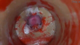 Insemination rage-anger Internal Camera Grips Deep Male Climax